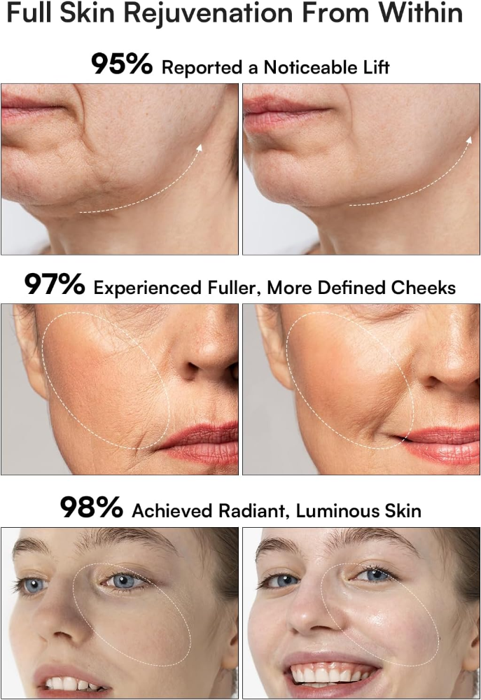 INIA Terapia de luz roja 3 en 1 para cara y cuello dispositivo de belleza para hinchazón y reafirmación de la piel herramienta de cuidado de la piel (blanco) - Imagen 5
